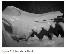 Regional Anesthesia for Dental Patients: Part I