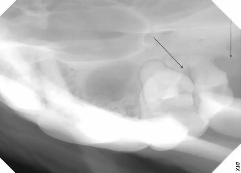 Left upper side, showing similar changes around 209 and 210.