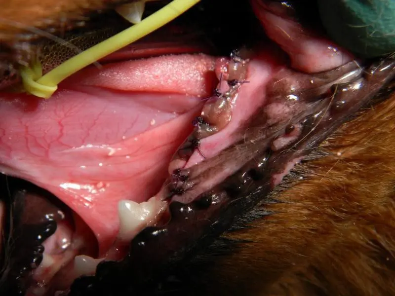 After extraction of 308/309/310/311, showing the absorbable suture material.