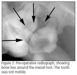 Treating trismus in dog