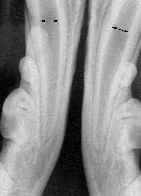 wide root canals in young canine patients