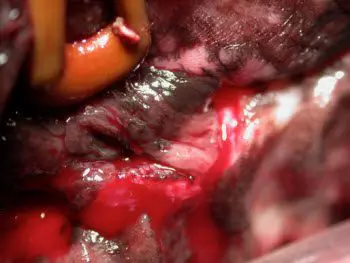 Figure 11. The flap is laid into place prior to closure to ensure that no tension will be present after closure. 