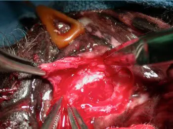 Figure 9. Undermine the base of the flap to lengthen it as needed. 