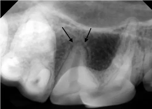 Dental X-ray of normal pet periodontal ligament