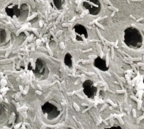 dentin tubules in pet teeth