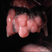 oral tumors in dogs