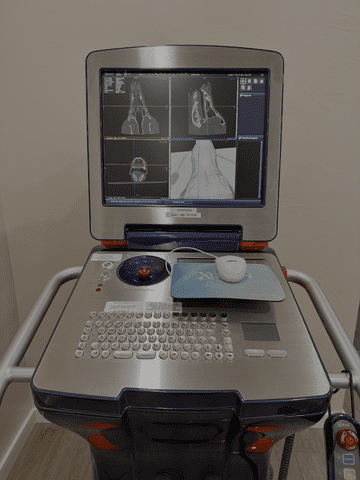 con beam ct imaging