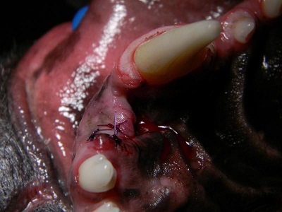 Figure 7. palatal view after treatment. 