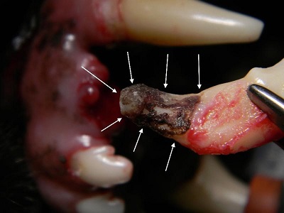 Figure 8. Tooth 203 after extraction, showing the the area of root resorption and calculus deposition on the root. 